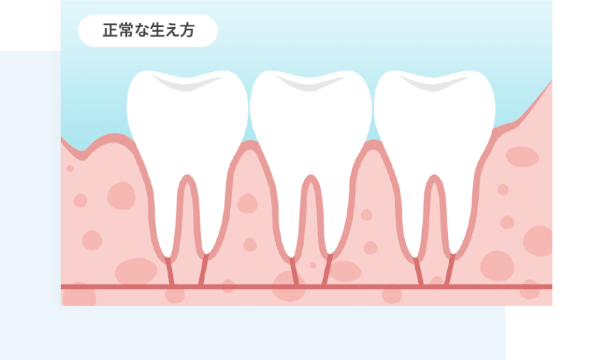 正常な口腔管理を促進