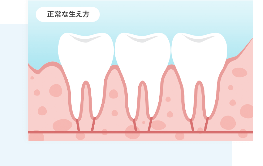 正常な口腔管理を促進
